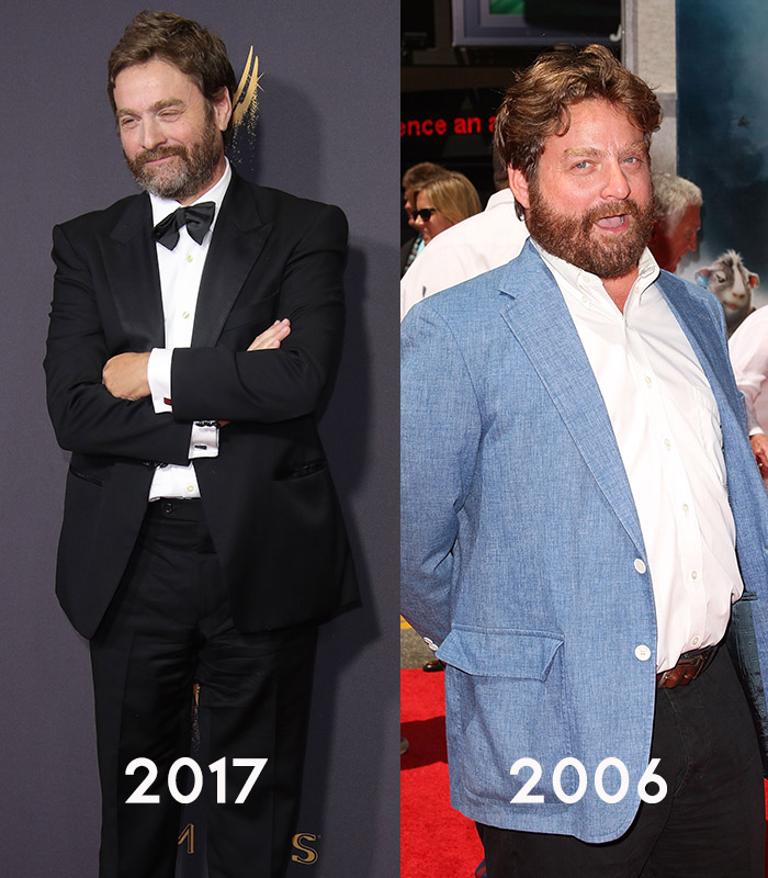 zach galifianakis skinny