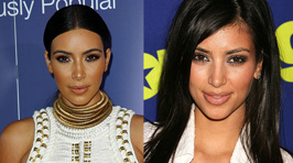 How Much Work Have The Kardashians Had Done?