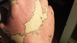 This Guy Transformed His Birthmark Into A Map Of An Imaginary World