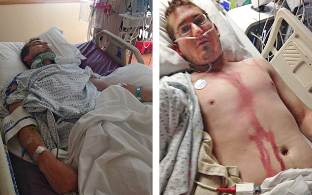 Story Time With Uncle Fletch: Man Survives Direct Lightning Strike To The Head