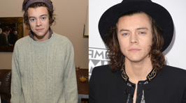 Photos: Harry Styles' Hair Transformation Through the Years