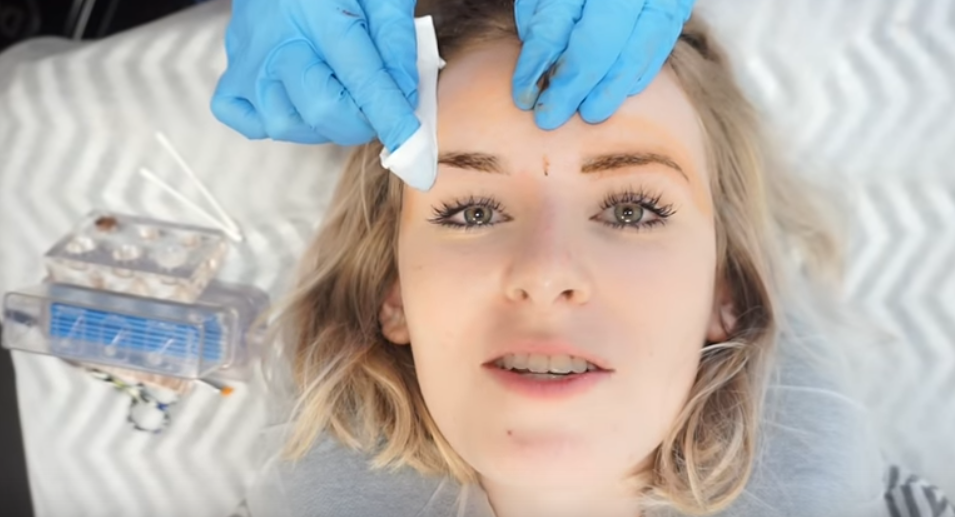 Sally Jo gets cosmetic tattoos