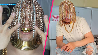 Dan Surt Rapper Rapper becomes first person to have gold chains surgically implanted ...