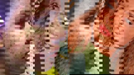 Skin transformation: Acne sufferer details budget-friendly skincare routine