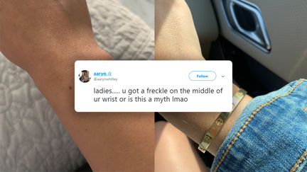 You probably have a freckle on your wrist