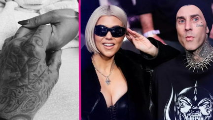 Kourtney Kardashian had to have "urgent fetal surgery" to save her baby's life
