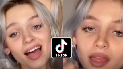 People are using makeup to create 'under-eye circles' in the latest fashion trend