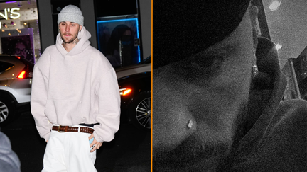 Justin Bieber opens up about anger amid text feud